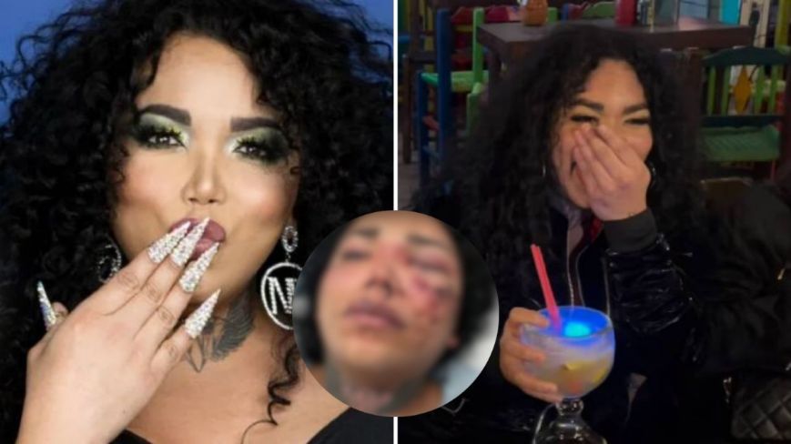 Paola Suárez de «Las Perdidas» es hospitalizada tras brutal golpiza